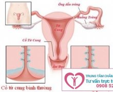 Những nguyên nhân gây phì đại cổ tử cung ở nữ giới