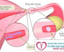 Biểu hiện và cách nhận biết bệnh vô sinh ở nữ giới