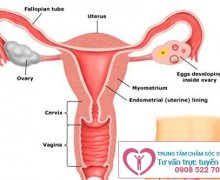 Bệnh vùng kín là những bệnh gì?