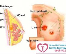 Biểu hiện của viêm tuyến vú