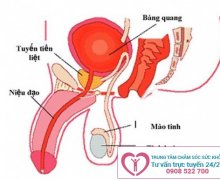 Làm sao để điều trị viêm niệu đạo ở nam giới?