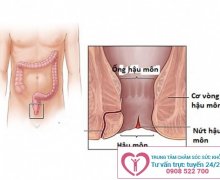 Bị rách hậu môn phải làm sao?