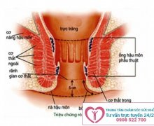 Hậu môn tiết dịch hôi là dấu hiệu của bệnh gì?