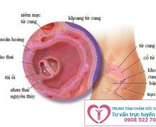 Thai 4 tuần có phá được không?