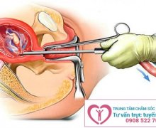 Phá thai bằng phương pháp hút chân không