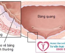 Dấu hiệu viêm niệu đạo ở nam giới