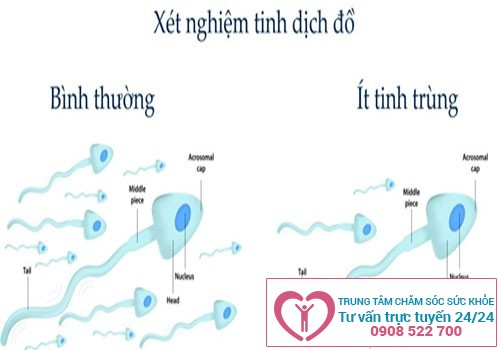 Tinh trùng ít khiến cho khả năng có con của nam giới giảm đi rất nhiều