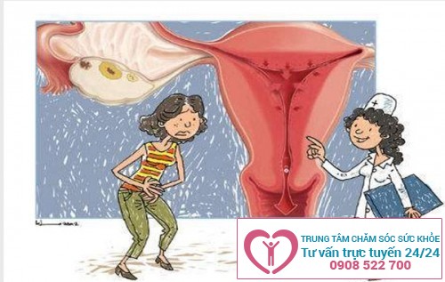 Nguyên nhân gây viêm niêm mạc tử cung có thể do viêm nhiễm sau khi nạo phá thai